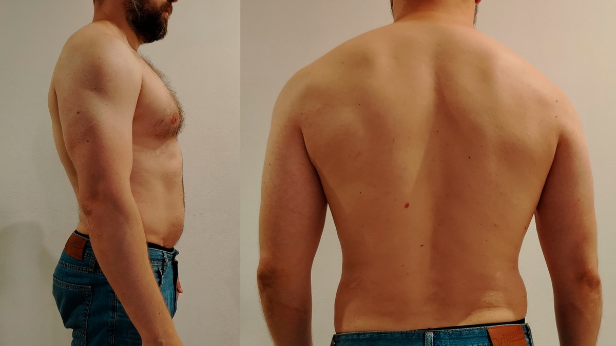 Тело обрело некую форму, но не прям Геракл. Кстати, видно, что у спины образовался перекос. Занимаюсь исправлением при помощи тяг гантелей. 