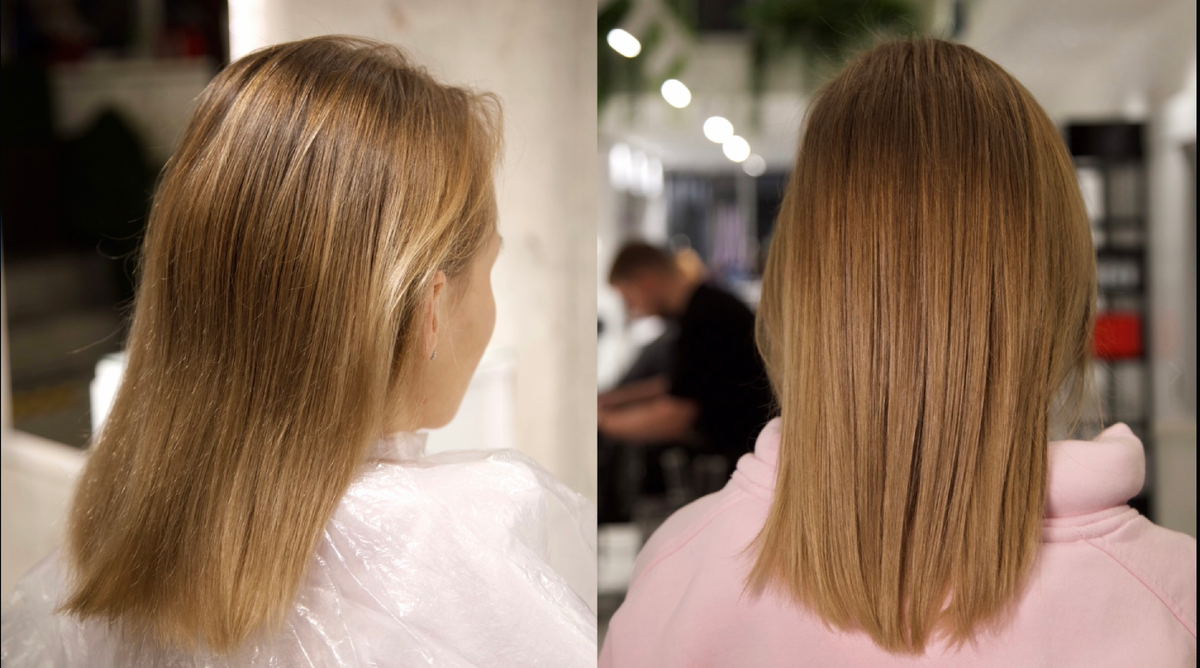 процедура «Гиалуроновое обертывание» – до/после