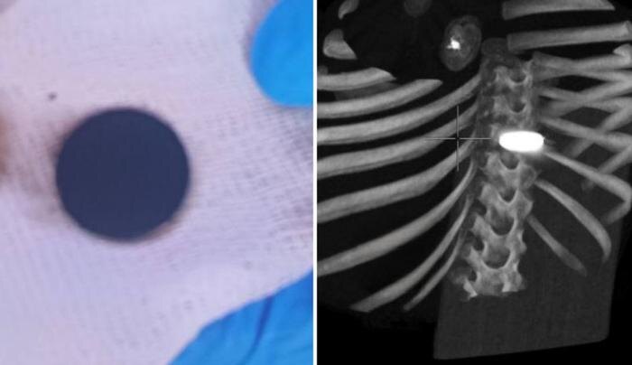 Обложка © Telegram / Наш Челябинск