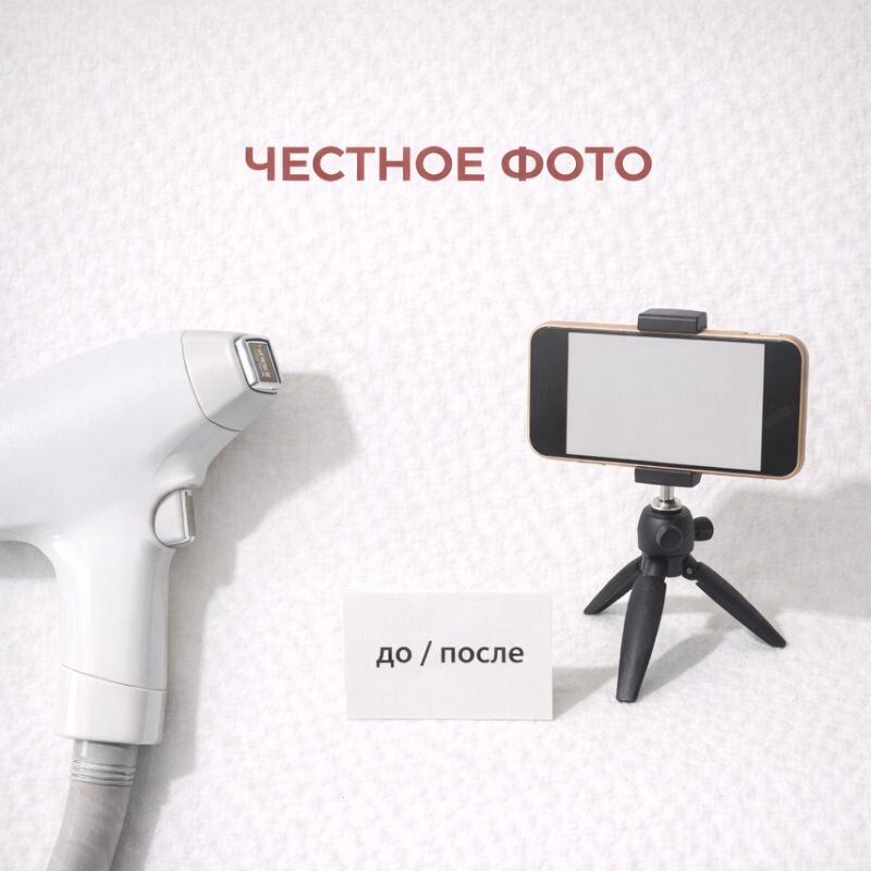 Лазерная эпиляция