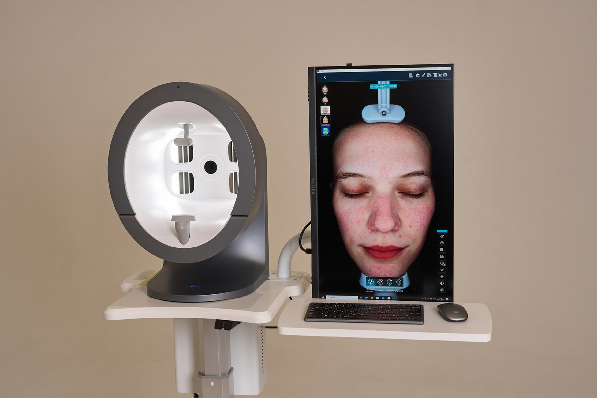 Анализатор кожи