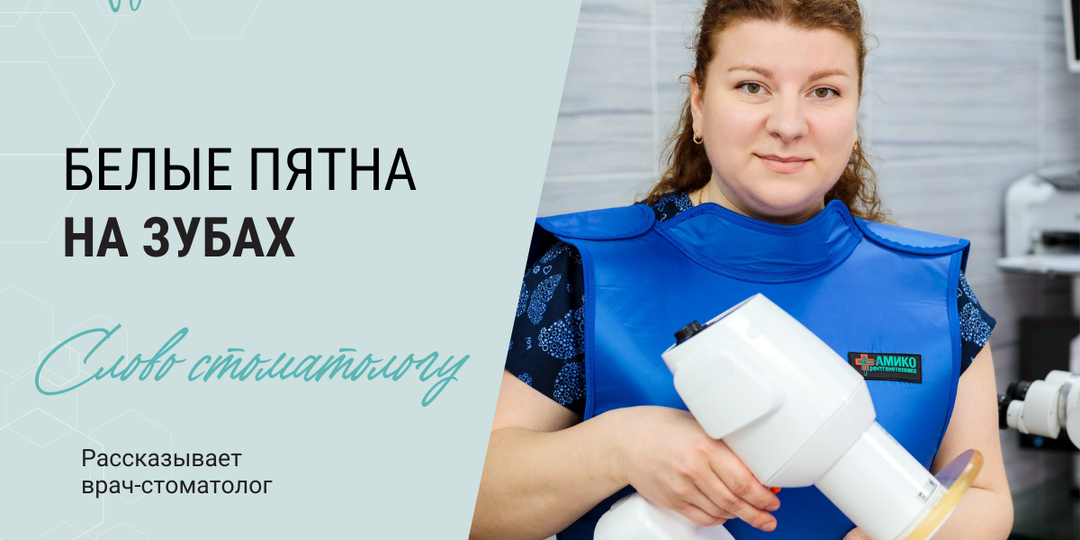 О чем говорят белые пятна на зубах