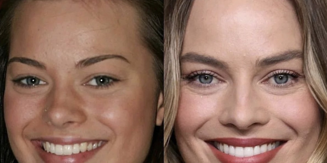 ЧЕК-ЛИСТ: Как понять, что вам не нужны виниры. Kaк красивые "зубы" могут испортить вам жизнь