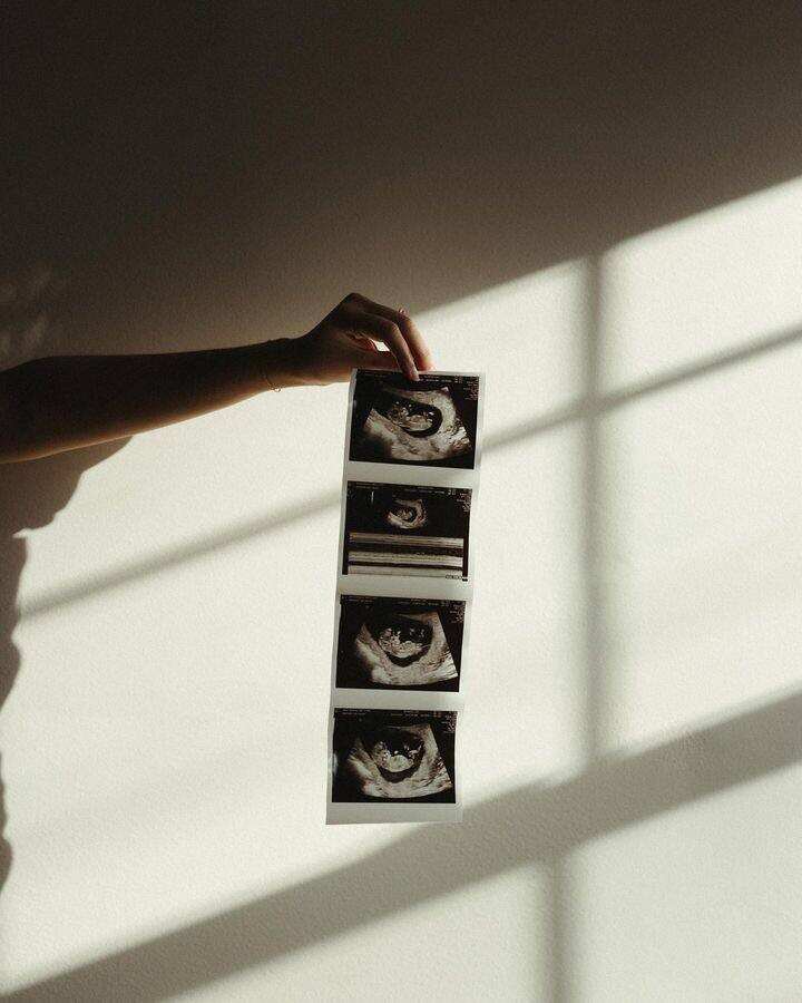 Сколько стоит ведение беременности в Москве? 