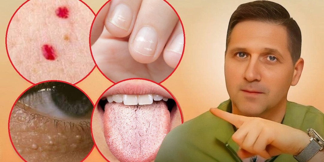 10 признаков нарушений в организме, которые многие игнорируют: от красных точек до трещин на пятках