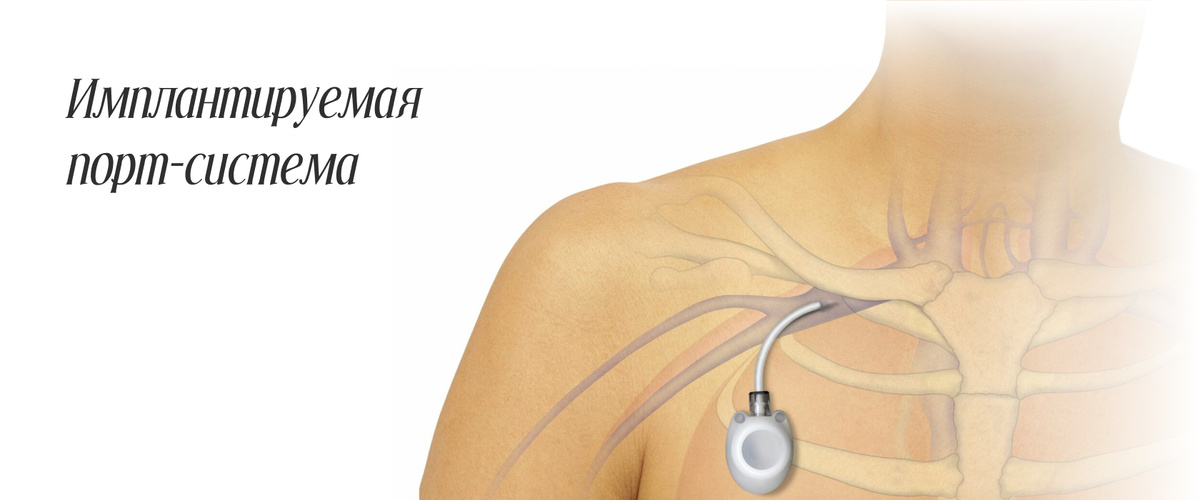 Фото с интернета