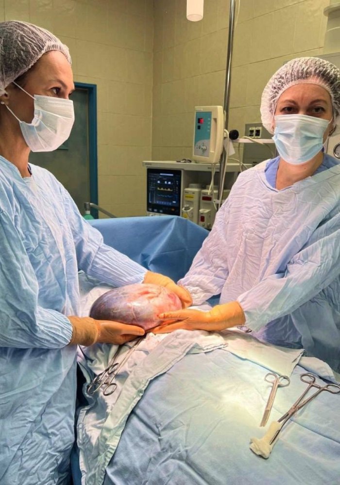    Врачи Югры удалили доброкачественную опухоль у 73-летней пациентки