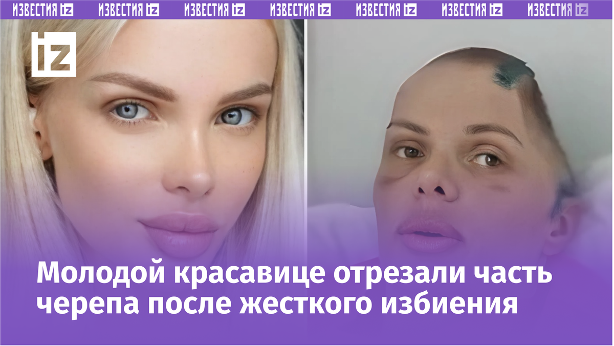 Фото с сайта Пятого канала