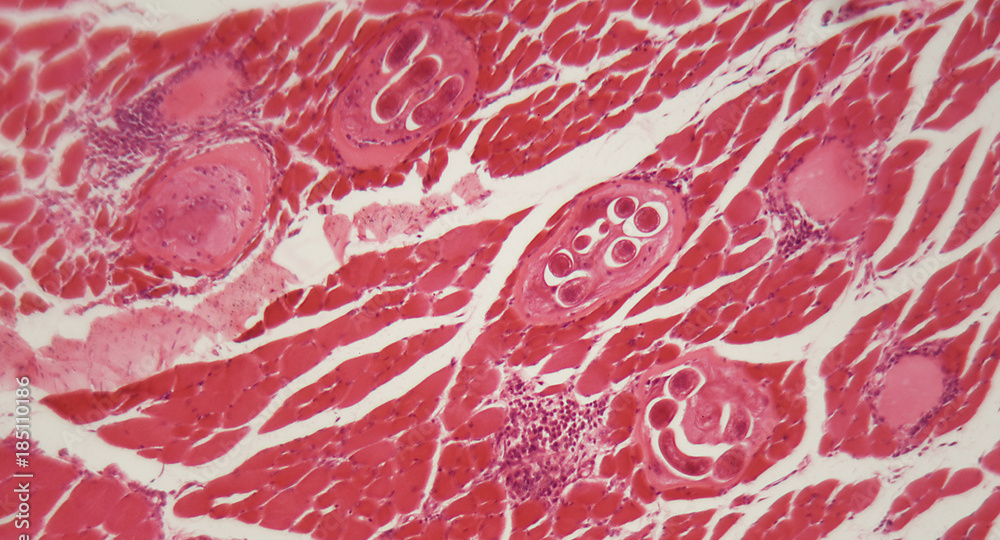 Что такое саркоспоридии и стоит ли их бояться?