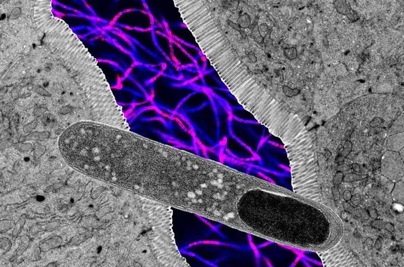    Внемасштабный коллаж из изображений под микроскопом, показывающий палочкообразную бактерию Turicibacter (на переднем плане), поперечный разрез кишечника и флуоресцентную микроскопию других бактерий (на заднем плане). Автор: Кендра Клаг,