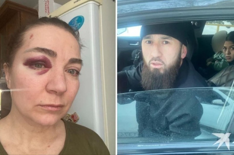    Агрессивная пара оставила женщине синяк. Фото: предоставлено героиней публикации