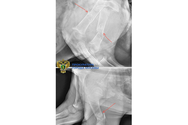    Рентген костей львицы, где видны переломы / Прокуратура города Москвы