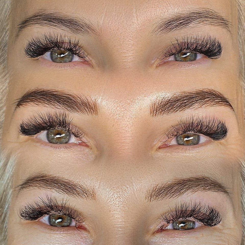 До/сразу после/зажившие