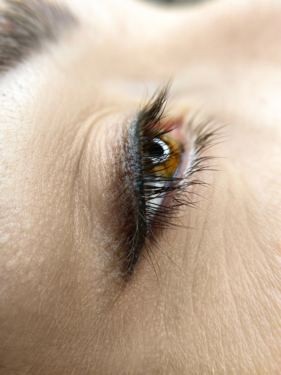 Зажившая стрелка