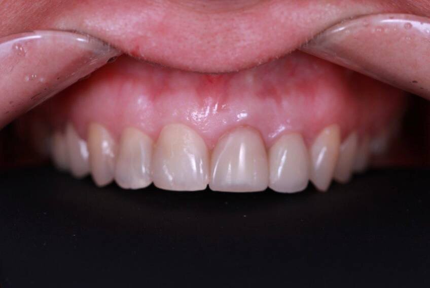 Клинический случай, выполненный врачом Малыхиной Татьяной Михайловной