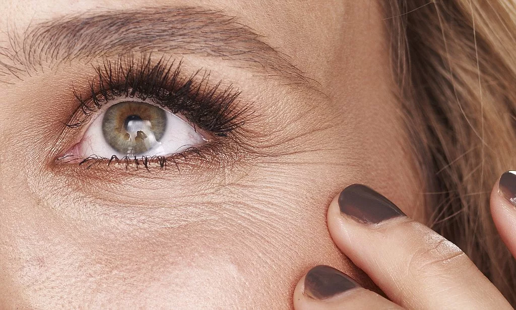 Постоянный прищур из-за зрения, солнца или усталости глаз приводит к хроническому напряжению мышц и ускоряет формирование стойких гусиных лапок.