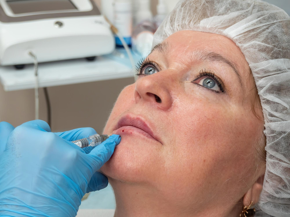 Опущенные уголки губ — это естественное возрастное и мимическое изменение, из-за которого лицо может выглядеть уставшим или грустным