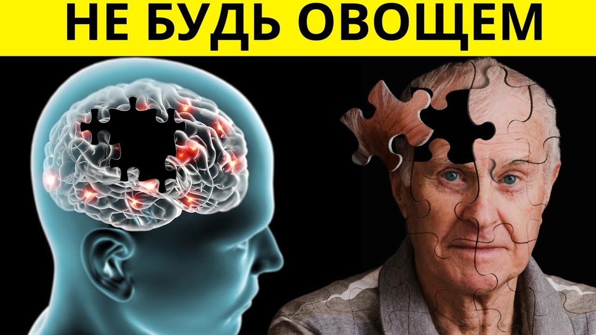 Невролог объяснил, какие сбои памяти требуют обследования (интервью)
