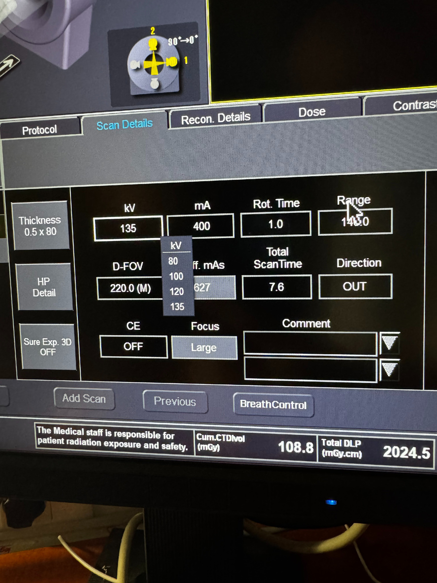 Интерфейс аппарата Canon. Установки кВ. 