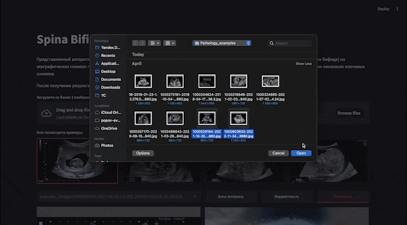     Интерфейс приложения для анализа признаков патологии центральной нервной системы на УЗИ беременных женщин Yandex Cloud Socialtech / Github