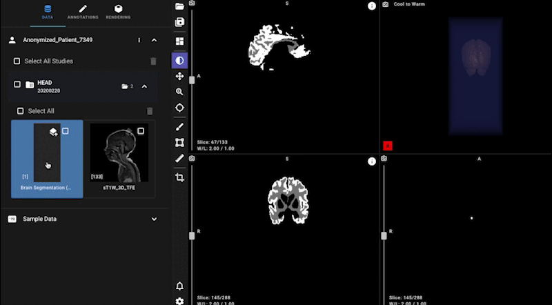     Интерфейс сервиса, который помогает помогает врачам анализировать результаты МРТ мозга младенцев Yandex Cloud Socialtech / Github