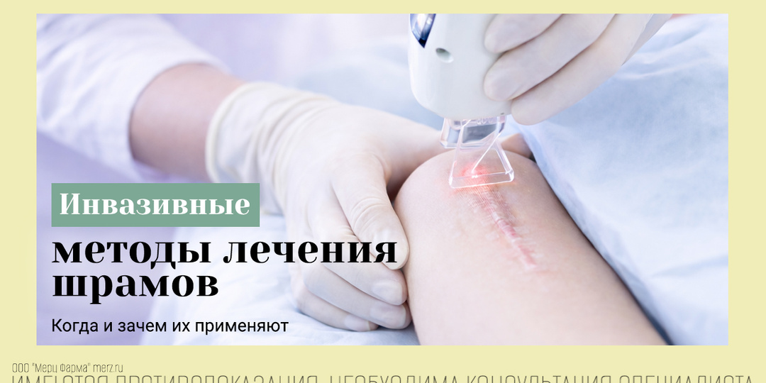 Методы лечения шрама – в чем их смысл и чем может помочь Контрактубекс