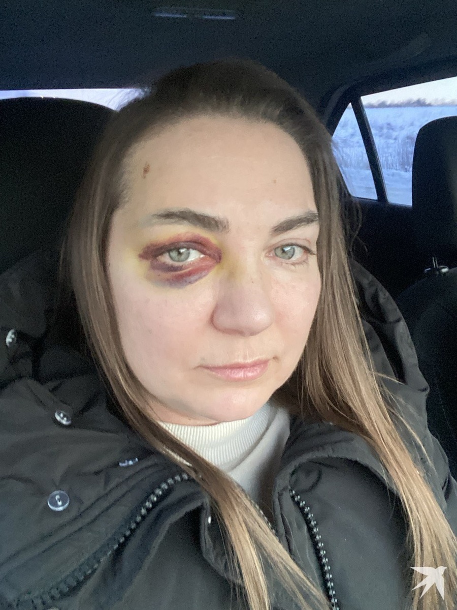    Из-за произошедшего Наталье пришлось отменить новогодние мероприятия. Фото: предоставлено пострадавшей