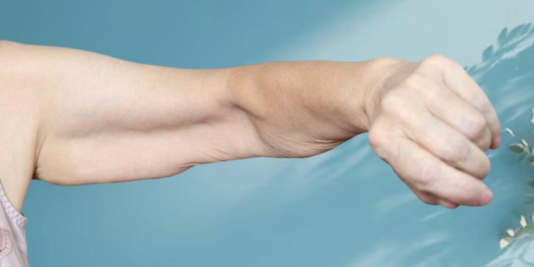 Мышцы слабеют, кожа провисает: как не довести тело до атрофии и остановить саркопению. Простые тесты и советы