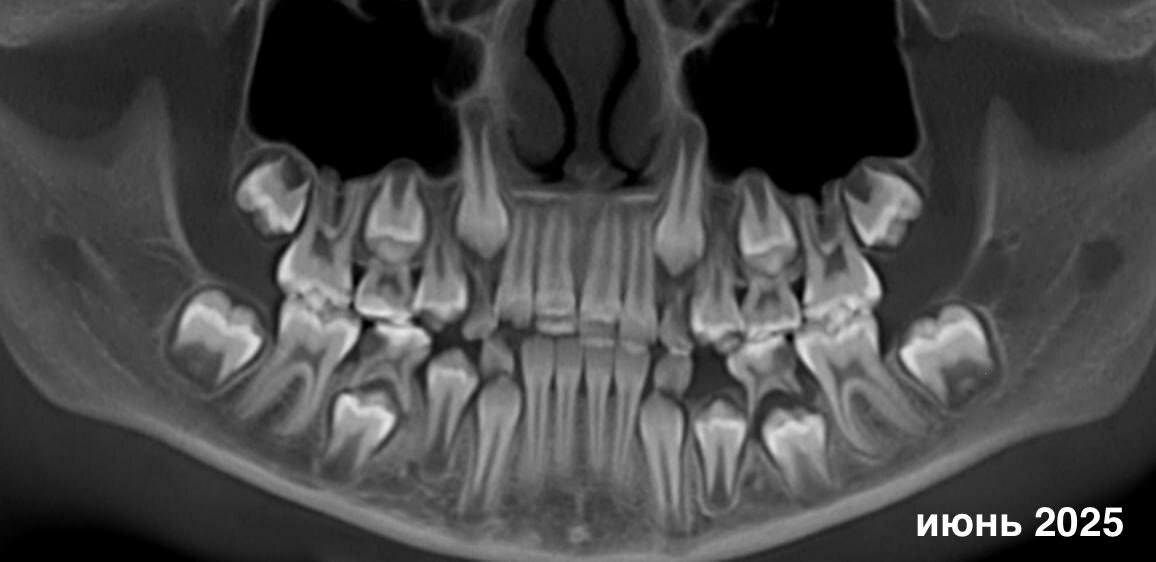 Листайте галерею вправо