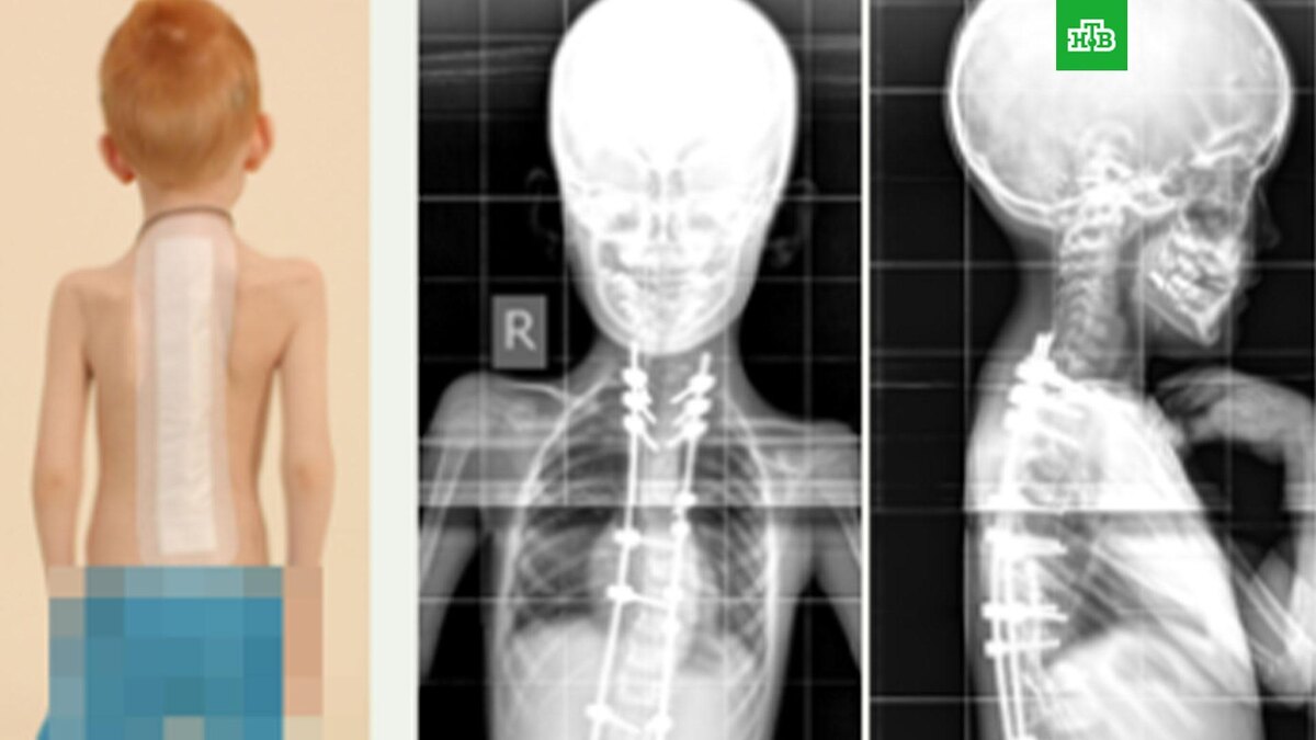    Фото: ilizarov.ru