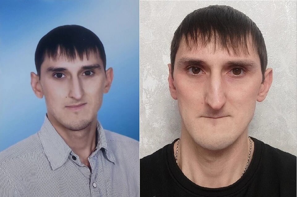 Слева мужчина до удаления зубов, справа - после. Фото: КП-Казань