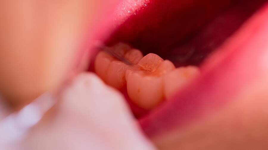    Фото: Global Look Press/Rolf Vennenbernd