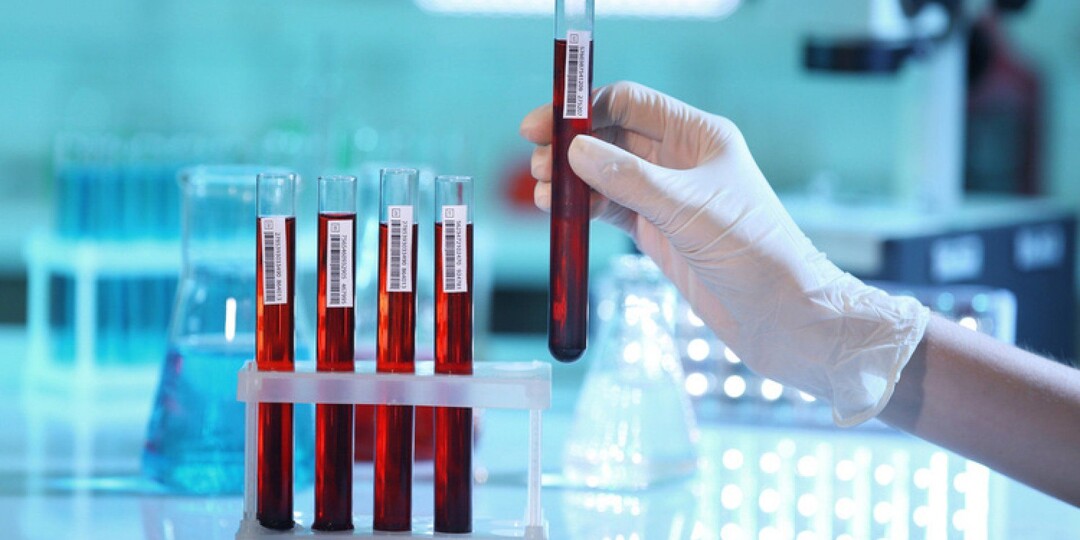 АЛТ и АСТ. Что за анализы , какие нормы и о чем говорят повышение или понижение