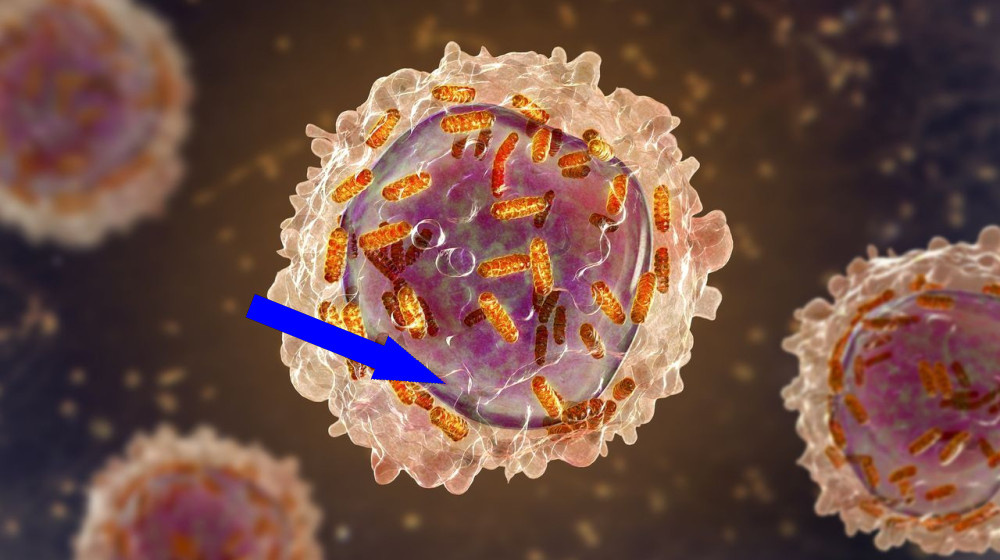    Женский гений, который изменил лечение рака у детей