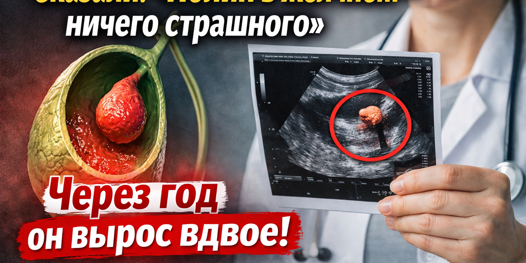 «Сказали: “Полип в желчном - ничего страшного”. Через год он вырос вдвое»