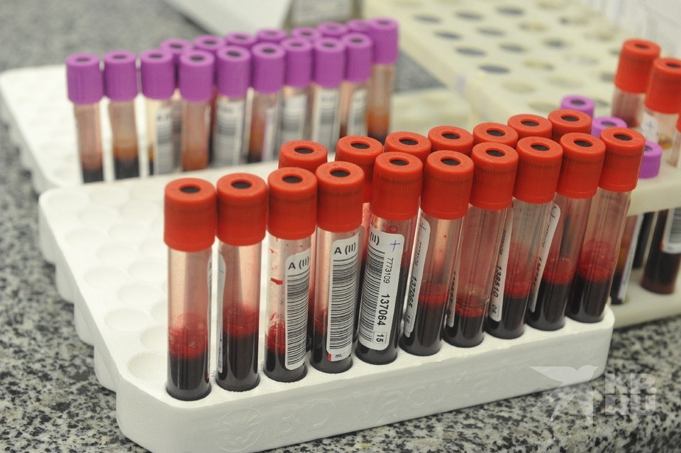    Губернатор Малков рассказал, как сдавал кровь в трех лечебных учреждениях и получил три разных результата. Владимир ВЕЛЕНГУРИН