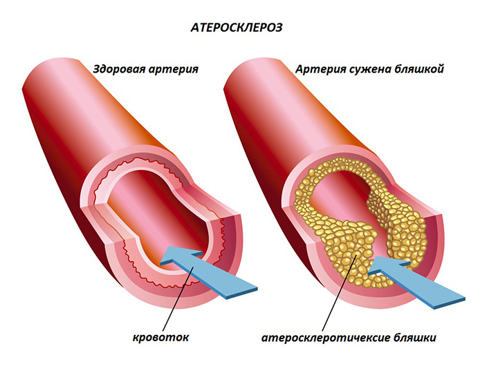 Источник: https://se.dreamstime.com, @Rob3000