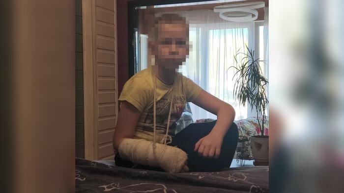 Архивное фото сына богородского маньяка с переломом руки неизвестного происхождения. Фото © SHOT