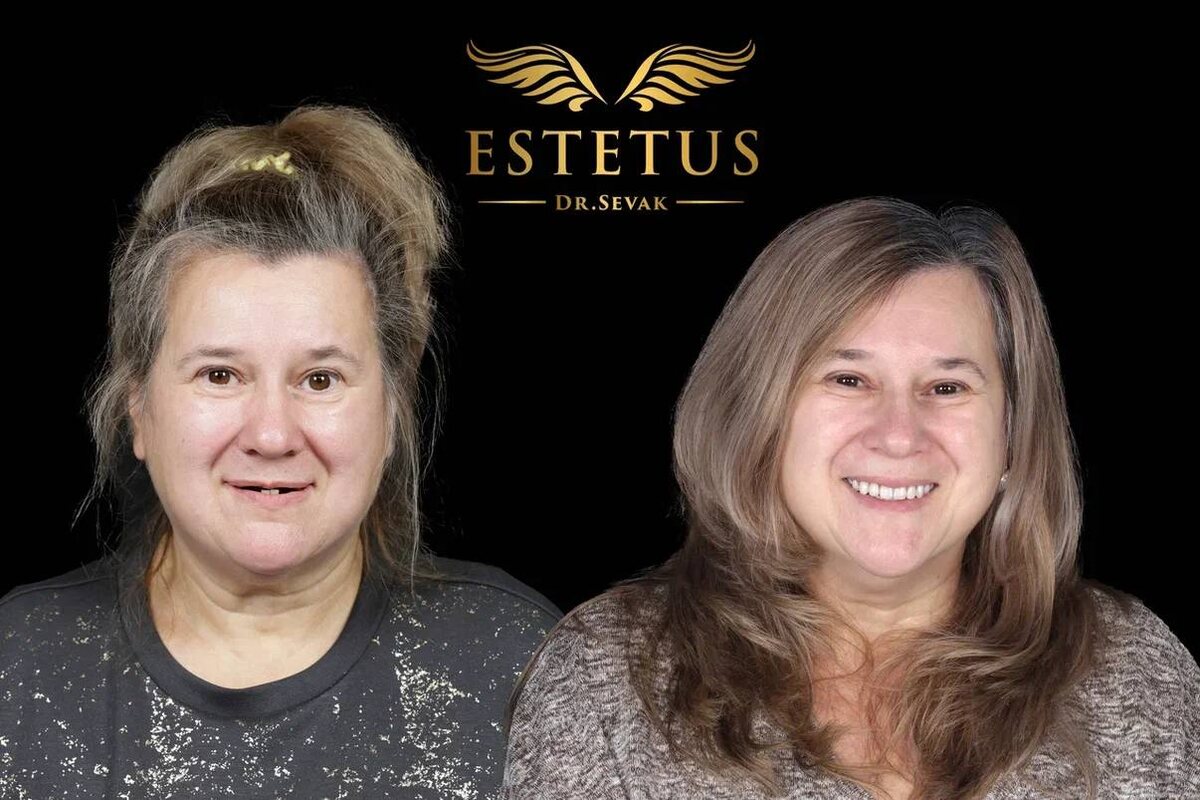 Владлена Владимировна, г. Москва, клиника доктора Севака Estetus