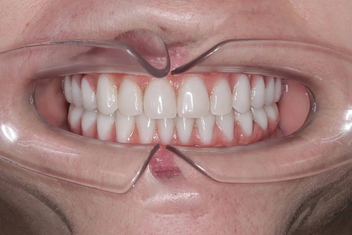 Владлена Владимировна, г. Москва, клиника доктора Севака Estetus