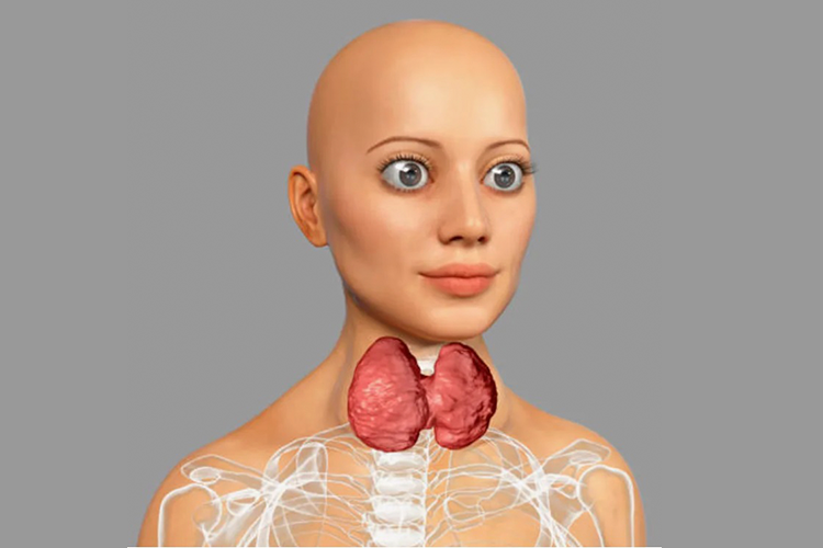 Щитовидка сильно увеличена и пронизана узлами. а анализы могут быть в пределах референса