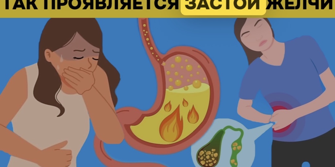 Растворение камней в желчном: почему врачи редко рекомендуют таблетки