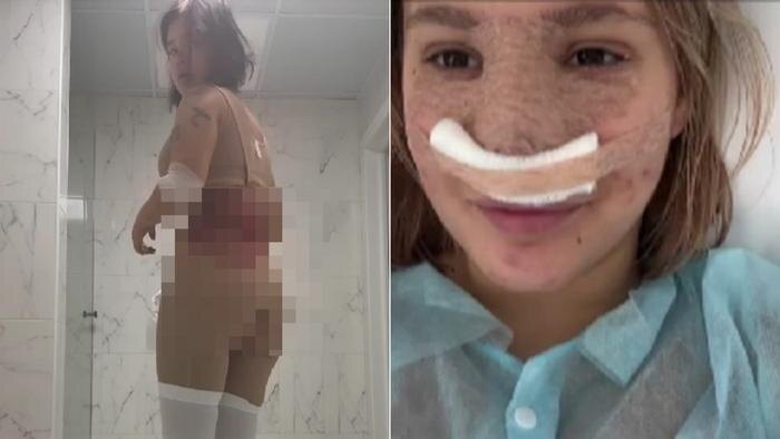 17-летняя дочь Даны Борисовой показала себя после пластических операций. Фото © Instagram (признан экстремистской организацией и запрещён на территории Российской Федерации)/ poxenovaaa