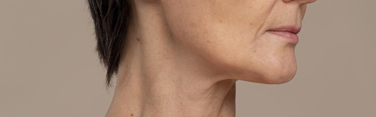 Брыли формируются из-за совокупности изменений мышц, связок и тканей нижней трети лица, а не по одной изолированной причине.