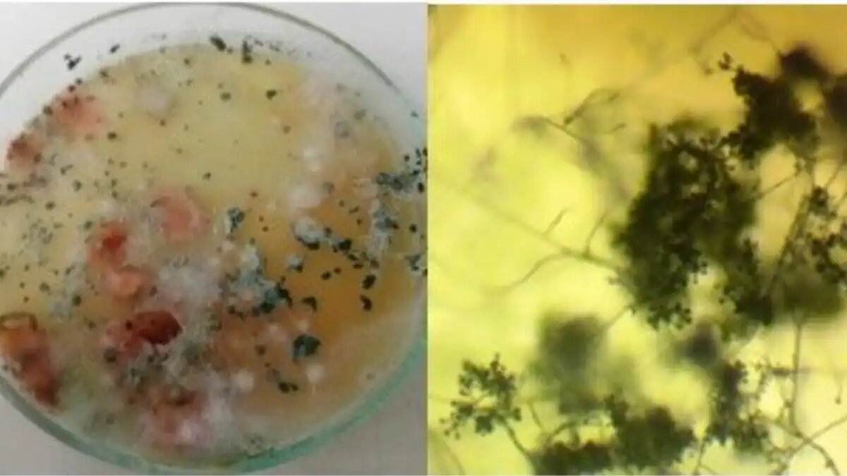 Фото:Россельхозцентр
Грибы рода Trichoderma spp.