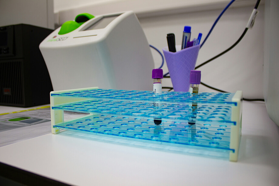 Пациенты вынуждены проходить значительную часть обследований в платных лабораториях. | Фото: Mezidi Zineb/Unsplash