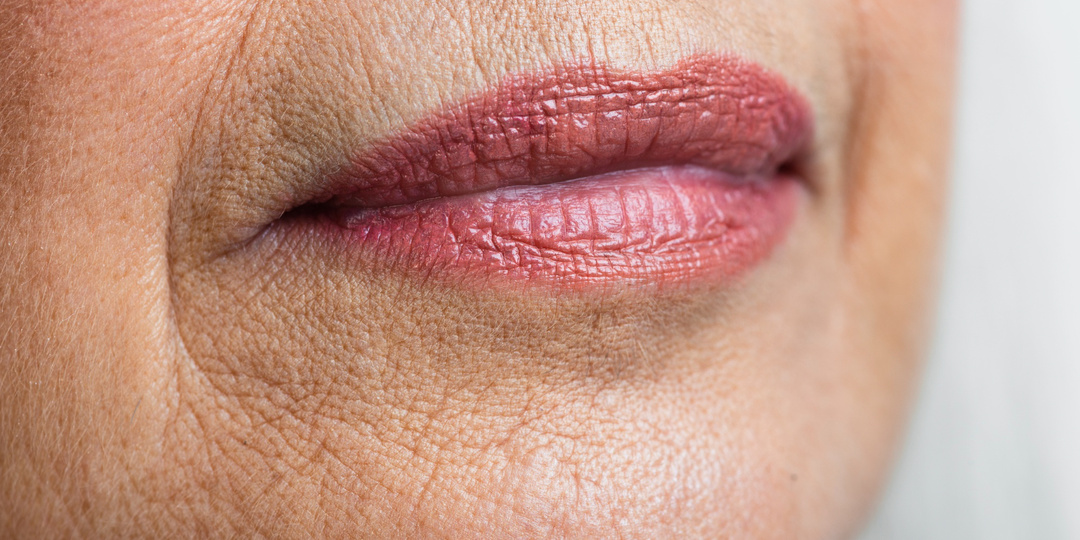 Как убрать морщины вокруг губ и над верхней губой дома