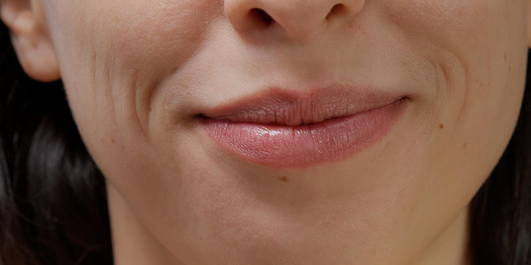 Как убрать кисетные морщины над верхней губой в клинике
