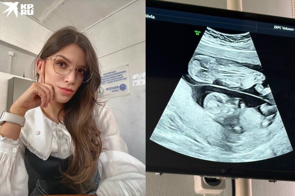    УЗИ показало, что будут близнецы. Фото: Предоставлены Викторией Токмаковой