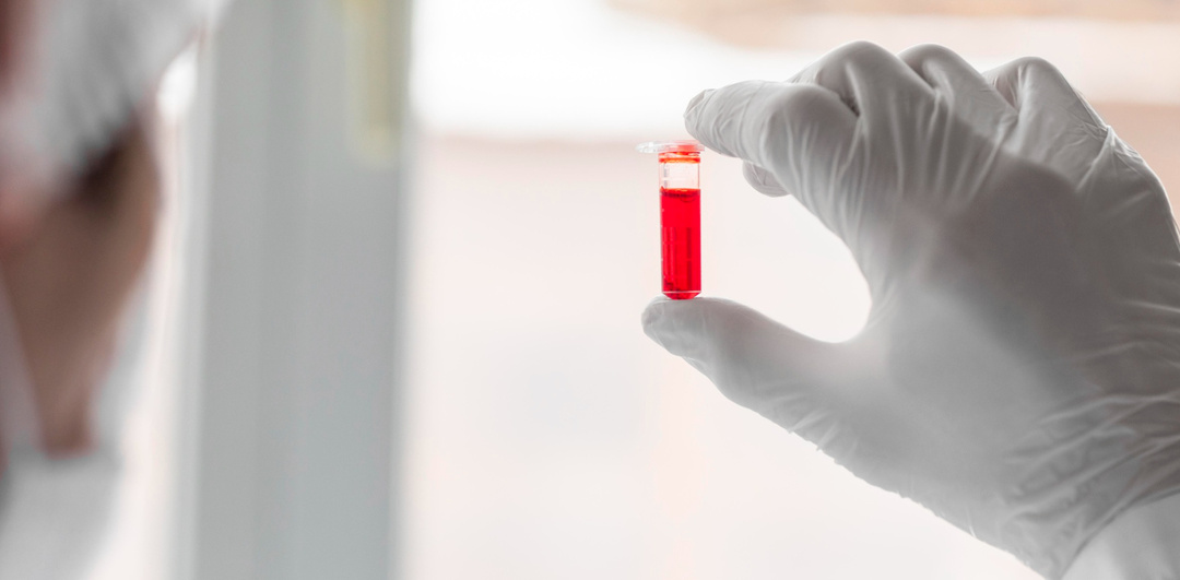 Как узнать свою группу крови?